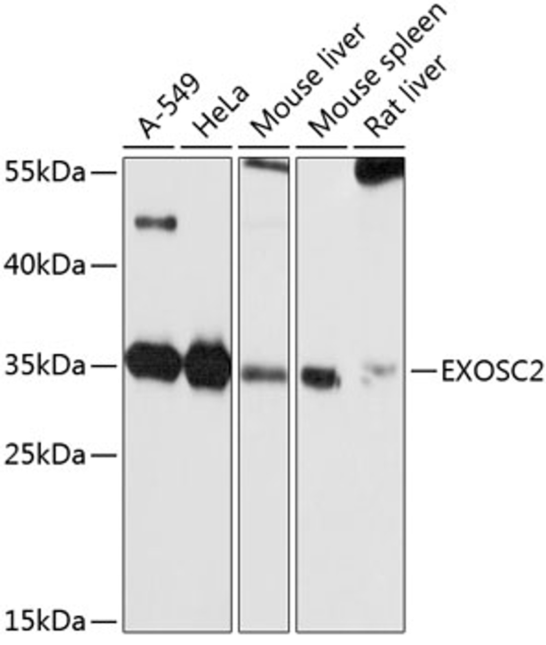 Western blot analysis of extracts of various cell lines, using EXOSC2 antibody (13-657) at 1:1000 dilution.<br/>Secondary antibody: HRP Goat Anti-Rabbit IgG (H+L) at 1:10000 dilution.<br/>Lysates/proteins: 25ug per lane.<br/>Blocking buffer: 3% nonfat dry milk in TBST.<br/>Detection: ECL Basic Kit.<br/>Exposure time: 5s.