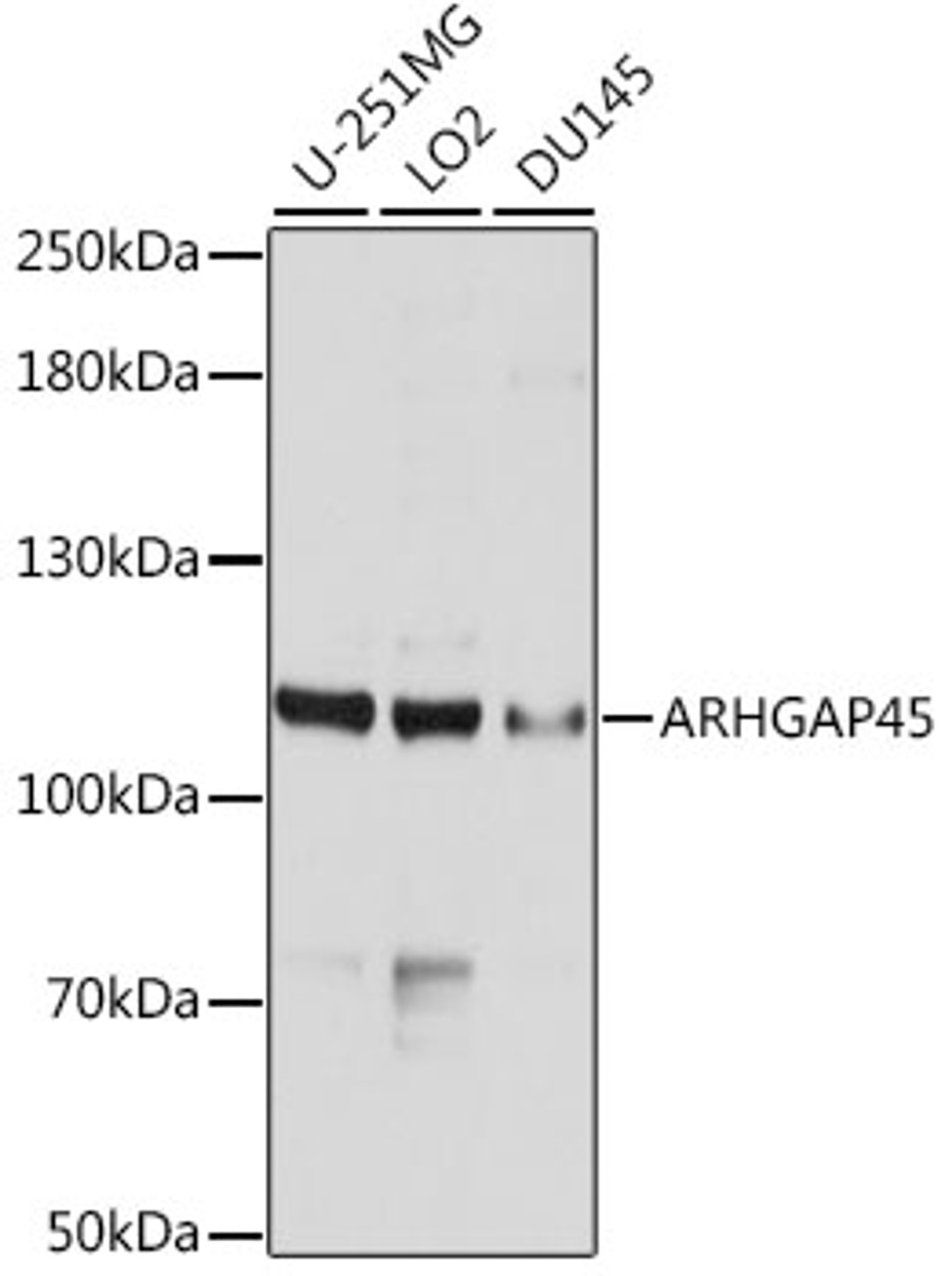 Western blot analysis of extracts of various cell lines, using ARHGAP45 antibody (13-660) at 1:1000 dilution.<br/>Secondary antibody: HRP Goat Anti-Rabbit IgG (H+L) at 1:10000 dilution.<br/>Lysates/proteins: 25ug per lane.<br/>Blocking buffer: 3% nonfat dry milk in TBST.<br/>Detection: ECL Basic Kit.<br/>Exposure time: 30s.