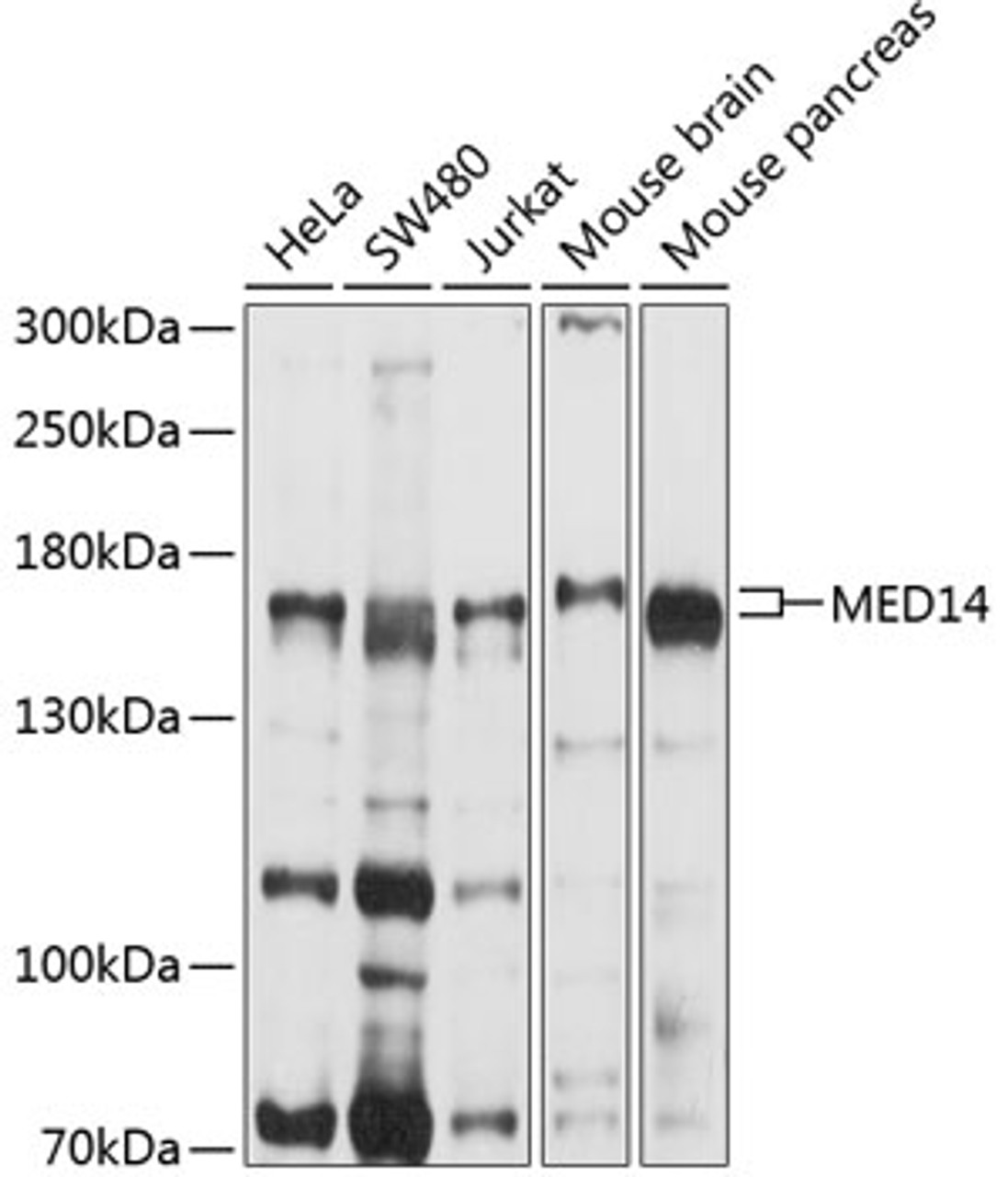 Western blot analysis of extracts of various cell lines, using MED14 antibody (13-661) at 1:1000 dilution.<br/>Secondary antibody: HRP Goat Anti-Rabbit IgG (H+L) at 1:10000 dilution.<br/>Lysates/proteins: 25ug per lane.<br/>Blocking buffer: 3% nonfat dry milk in TBST.<br/>Detection: ECL Basic Kit.<br/>Exposure time: 5s.