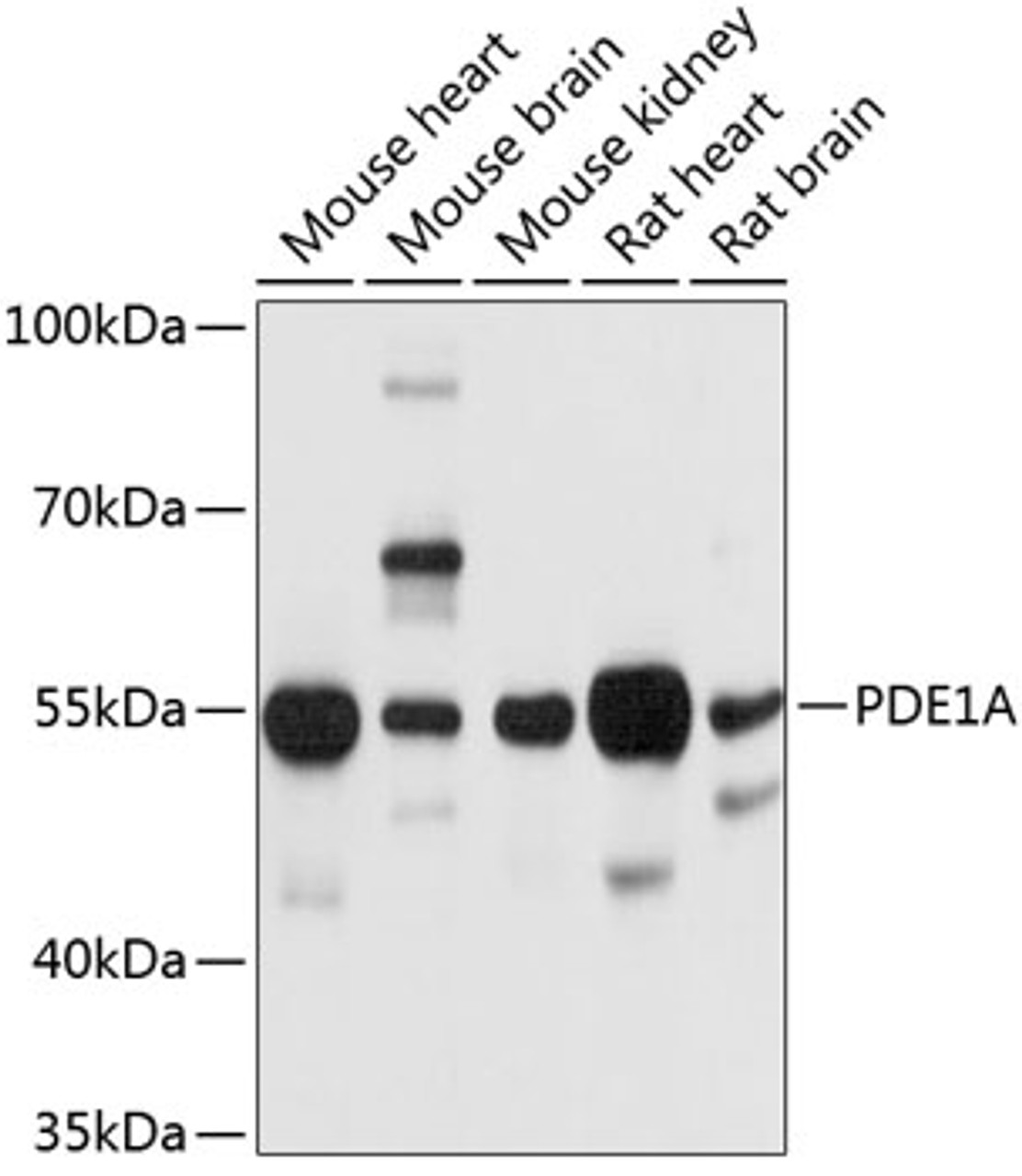 Western blot analysis of extracts of various cell lines, using PDE1A antibody (13-662) at 1:1000 dilution.<br/>Secondary antibody: HRP Goat Anti-Rabbit IgG (H+L) at 1:10000 dilution.<br/>Lysates/proteins: 25ug per lane.<br/>Blocking buffer: 3% nonfat dry milk in TBST.<br/>Detection: ECL Basic Kit.<br/>Exposure time: 10s.