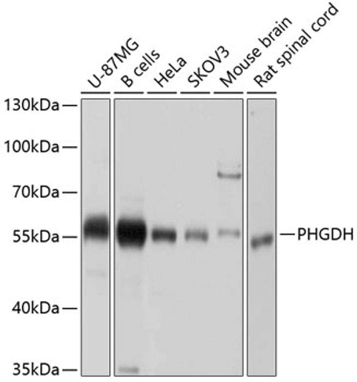 Western blot analysis of extracts of various cell lines, using PHGDH antibody (13-666) at 1:1000 dilution.<br/>Secondary antibody: HRP Goat Anti-Rabbit IgG (H+L) at 1:10000 dilution.<br/>Lysates/proteins: 25ug per lane.<br/>Blocking buffer: 3% nonfat dry milk in TBST.<br/>Detection: ECL Basic Kit.<br/>Exposure time: 5s.