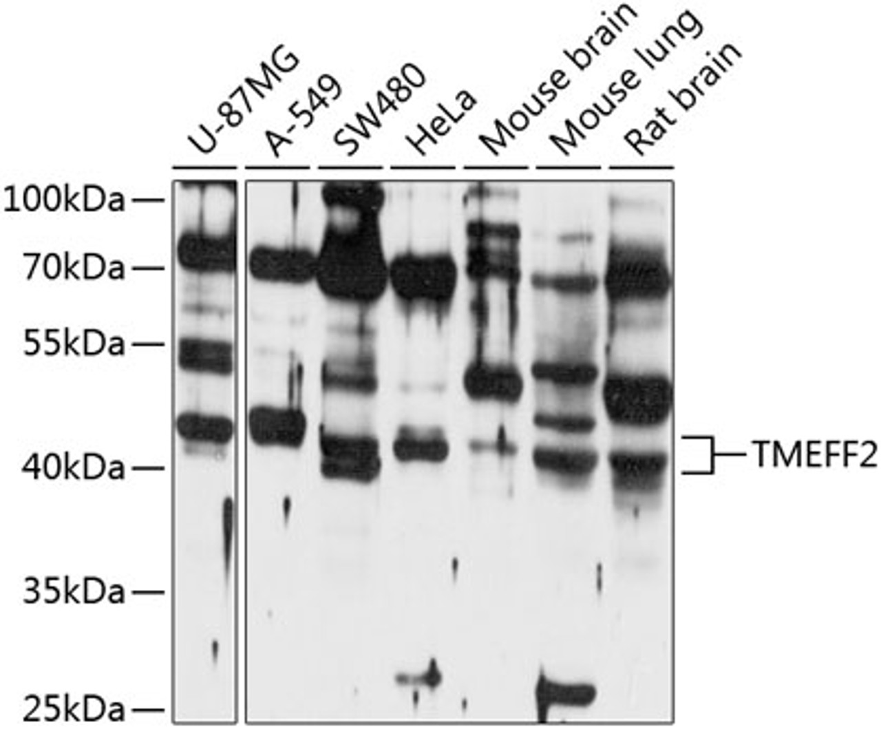 Western blot analysis of extracts of various cell lines, using TMEFF2 antibody (13-668) at 1:1000 dilution.<br/>Secondary antibody: HRP Goat Anti-Rabbit IgG (H+L) at 1:10000 dilution.<br/>Lysates/proteins: 25ug per lane.<br/>Blocking buffer: 3% nonfat dry milk in TBST.<br/>Detection: ECL Basic Kit.<br/>Exposure time: 10s.