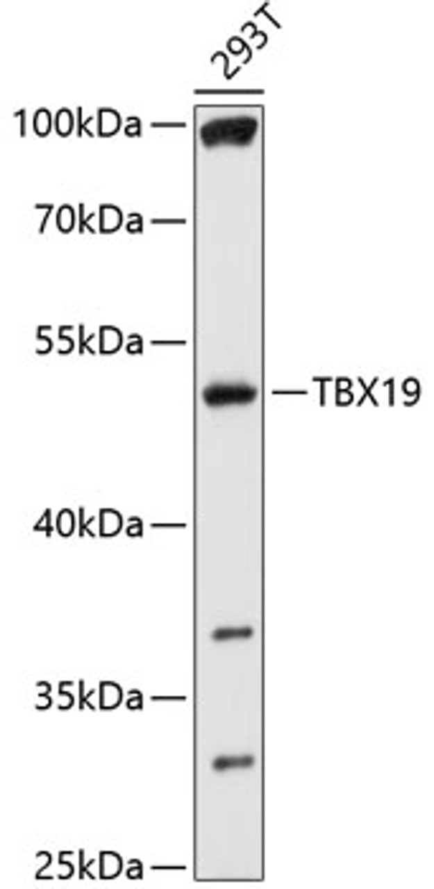 Western blot analysis of extracts of 293T cells, using TBX19 antibody (13-678) at 1:1000 dilution.<br/>Secondary antibody: HRP Goat Anti-Rabbit IgG (H+L) at 1:10000 dilution.<br/>Lysates/proteins: 25ug per lane.<br/>Blocking buffer: 3% nonfat dry milk in TBST.<br/>Detection: ECL Basic Kit.<br/>Exposure time: 30s.