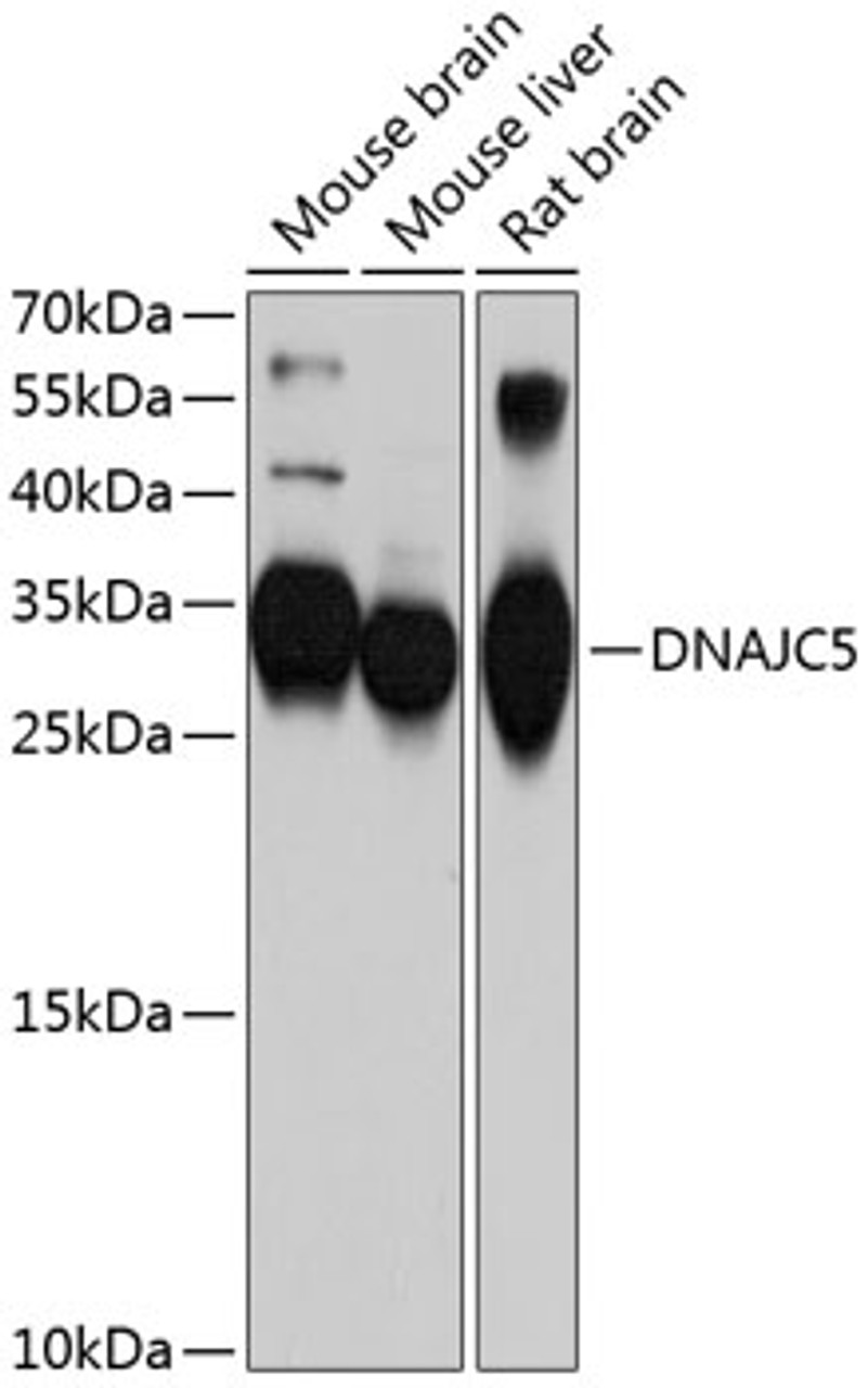 Western blot analysis of extracts of various cell lines, using DNAJC5 antibody (13-683) at 1:1000 dilution.<br/>Secondary antibody: HRP Goat Anti-Rabbit IgG (H+L) at 1:10000 dilution.<br/>Lysates/proteins: 25ug per lane.<br/>Blocking buffer: 3% nonfat dry milk in TBST.<br/>Detection: ECL Basic Kit.<br/>Exposure time: 90s.