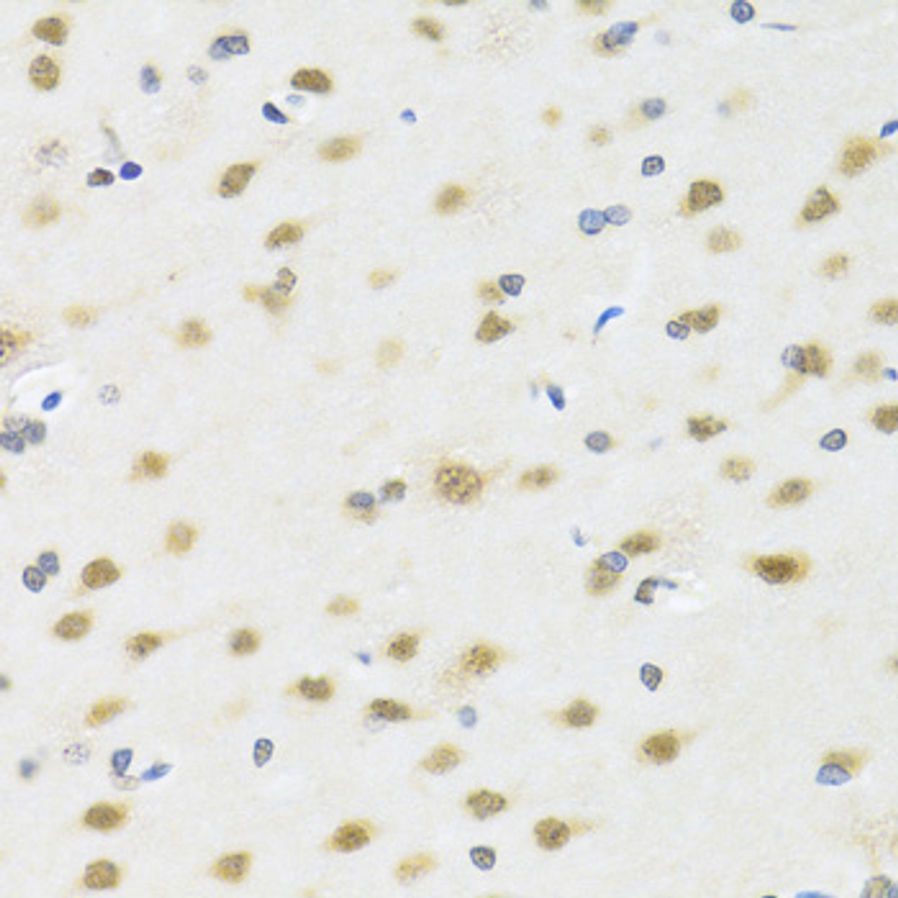 Immunohistochemistry of paraffin-embedded rat brain using MTAP antibody (13-684) at dilution of 1:100 (40x lens) .