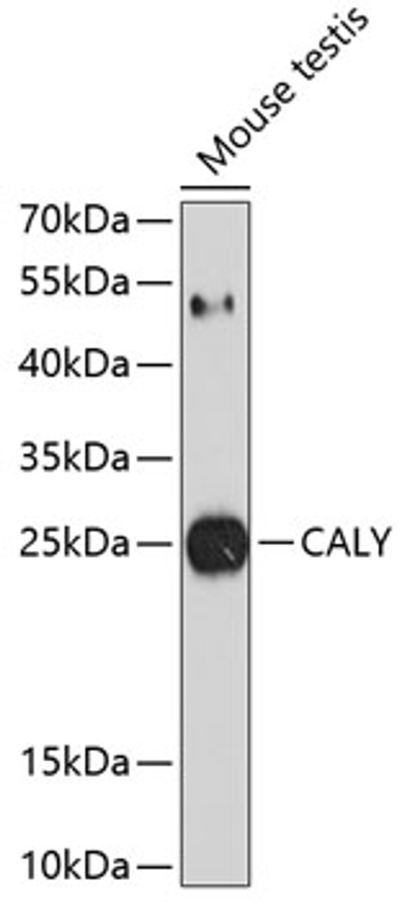 Western blot analysis of extracts of mouse testis, using CALY antibody (13-689) at 1:1000 dilution.<br/>Secondary antibody: HRP Goat Anti-Rabbit IgG (H+L) at 1:10000 dilution.<br/>Lysates/proteins: 25ug per lane.<br/>Blocking buffer: 3% nonfat dry milk in TBST.<br/>Detection: ECL Basic Kit.<br/>Exposure time: 90s.