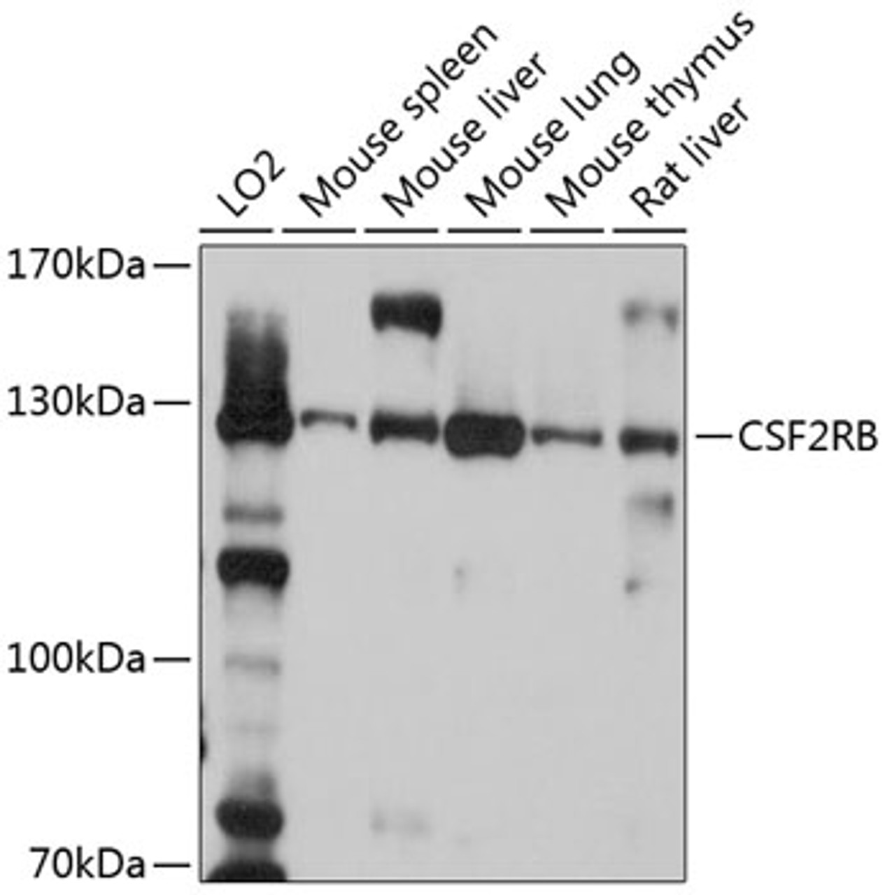 Western blot analysis of extracts of various cell lines, using CSF2RB antibody (13-691) at 1:1000 dilution.<br/>Secondary antibody: HRP Goat Anti-Rabbit IgG (H+L) at 1:10000 dilution.<br/>Lysates/proteins: 25ug per lane.<br/>Blocking buffer: 3% nonfat dry milk in TBST.<br/>Detection: ECL Basic Kit.<br/>Exposure time: 10s.