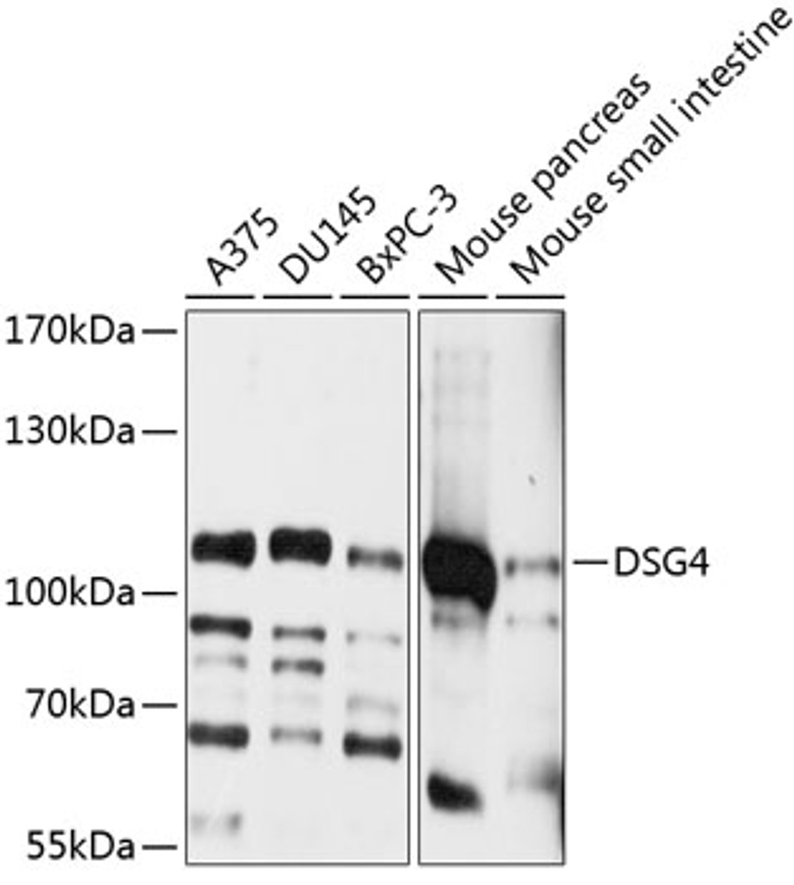 Western blot analysis of extracts of various cell lines, using DSG4 antibody (13-692) at 1:1000 dilution.<br/>Secondary antibody: HRP Goat Anti-Rabbit IgG (H+L) at 1:10000 dilution.<br/>Lysates/proteins: 25ug per lane.<br/>Blocking buffer: 3% nonfat dry milk in TBST.<br/>Detection: ECL Basic Kit.<br/>Exposure time: 1s.