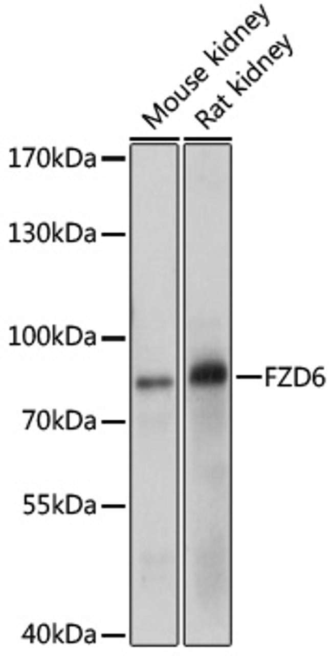 Western blot analysis of extracts of various cell line, using FZD6 antibody (13-693) at 1:1000 dilution.<br/>Secondary antibody: HRP Goat Anti-Rabbit IgG (H+L) at 1:10000 dilution.<br/>Lysates/proteins: 25ug per lane.<br/>Blocking buffer: 3% nonfat dry milk in TBST.<br/>Detection: ECL Basic Kit.<br/>Exposure time: 10s.