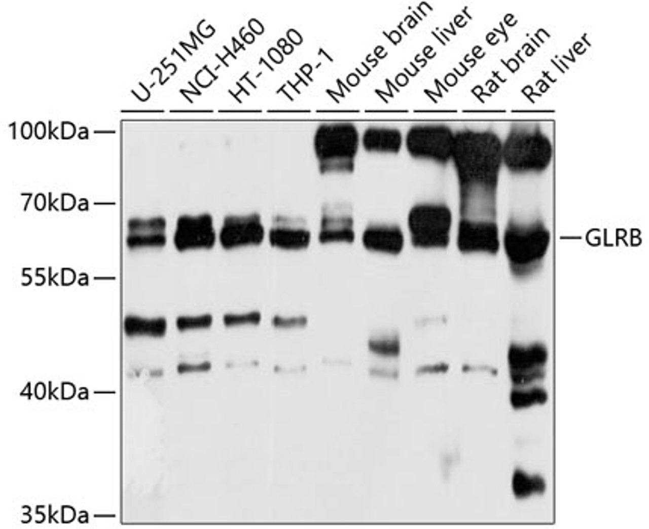Western blot analysis of extracts of various cell lines, using GLRB antibody (13-695) at 1:1000 dilution.<br/>Secondary antibody: HRP Goat Anti-Rabbit IgG (H+L) at 1:10000 dilution.<br/>Lysates/proteins: 25ug per lane.<br/>Blocking buffer: 3% nonfat dry milk in TBST.<br/>Detection: ECL Basic Kit.<br/>Exposure time: 10s.