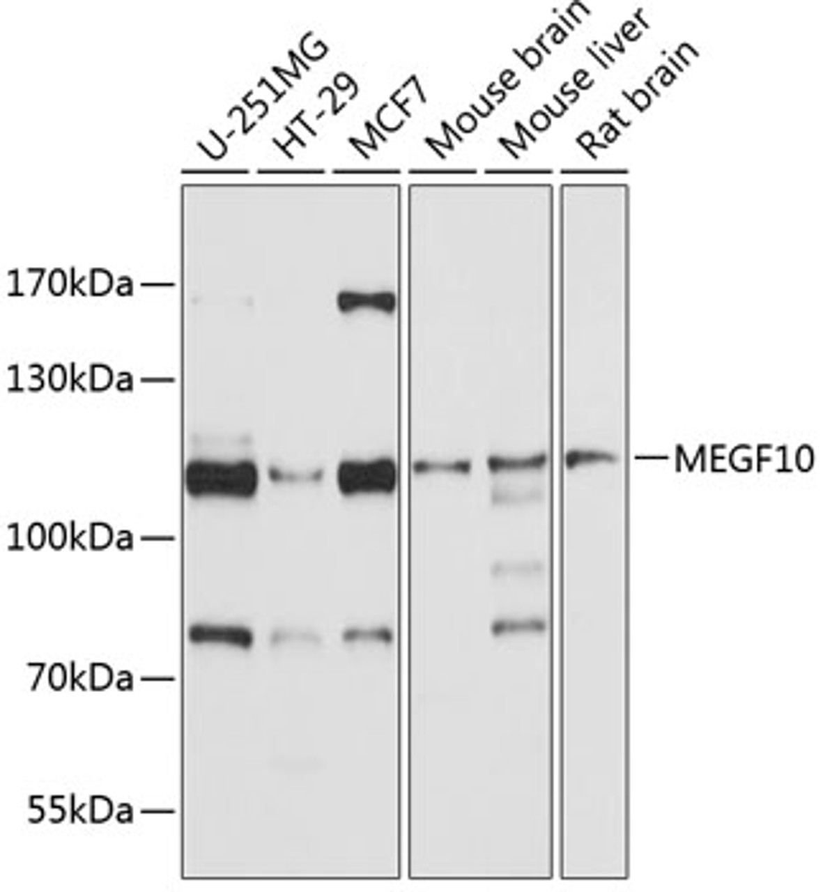 Western blot analysis of extracts of various cell lines, using MEGF10 antibody (13-696) at 1:1000 dilution.<br/>Secondary antibody: HRP Goat Anti-Rabbit IgG (H+L) at 1:10000 dilution.<br/>Lysates/proteins: 25ug per lane.<br/>Blocking buffer: 3% nonfat dry milk in TBST.<br/>Detection: ECL Basic Kit.<br/>Exposure time: 10s.