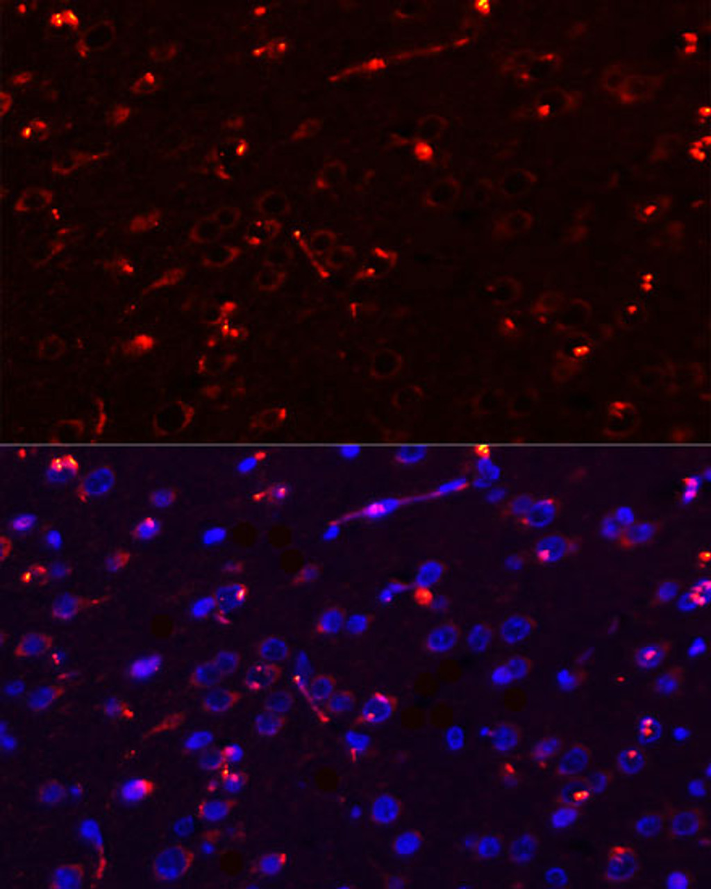 Immunofluorescence analysis of rat brain using MEGF10 antibody (13-696) at dilution of 1:100. Blue: DAPI for nuclear staining.