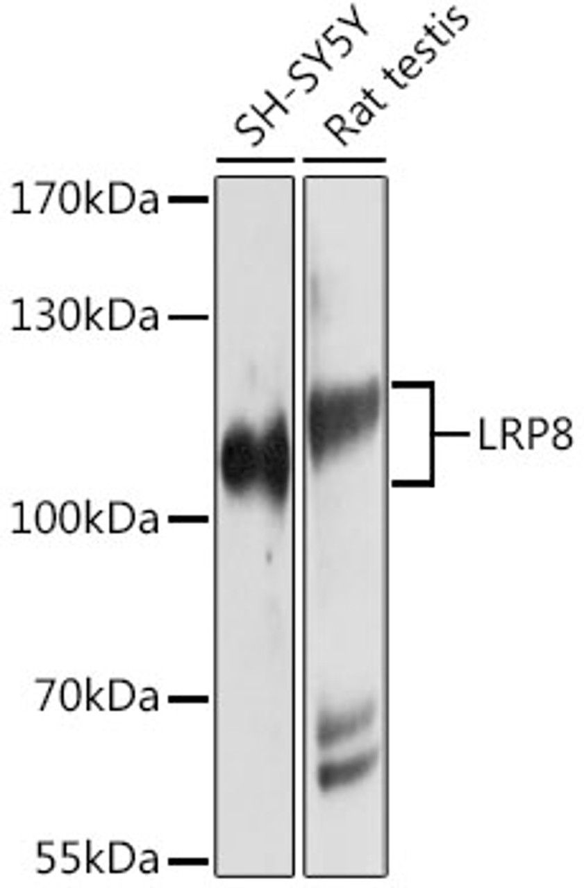 Western blot analysis of extracts of various cell lines, using LRP8 antibody (13-704) at 1:1000 dilution.<br/>Secondary antibody: HRP Goat Anti-Rabbit IgG (H+L) at 1:10000 dilution.<br/>Lysates/proteins: 25ug per lane.<br/>Blocking buffer: 3% nonfat dry milk in TBST.<br/>Detection: ECL Basic Kit.<br/>Exposure time: 30s.