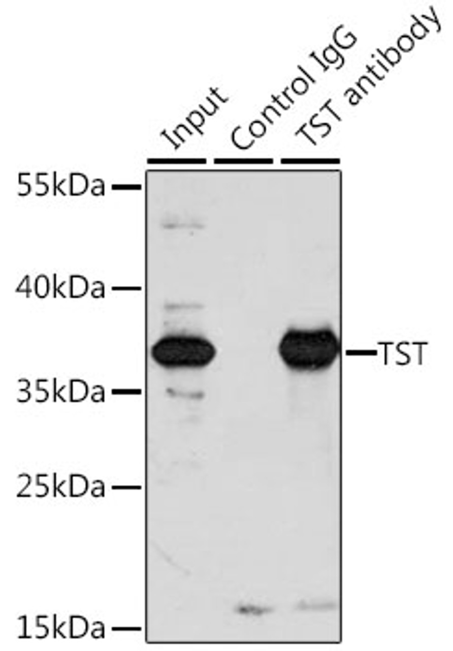 Immunoprecipitation analysis of 200ug extracts of A-549 cells, using 3 ug TST antibody (13-709) . Western blot was performed from the immunoprecipitate using TST antibody (13-709) at a dilition of 1:1000.