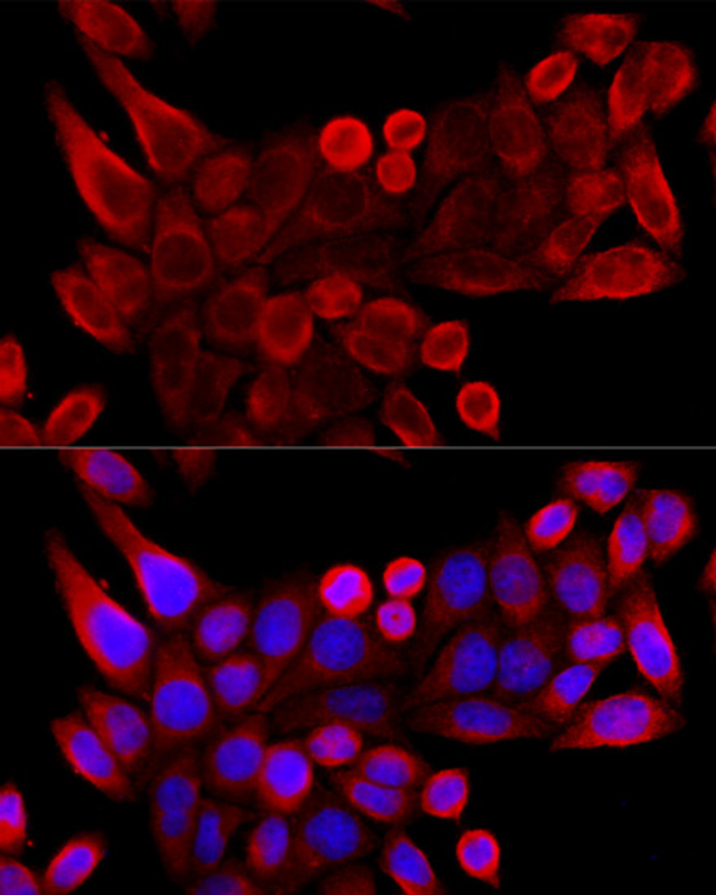 Immunofluorescence analysis of HeLa cells using VDAC3 antibody (13-710) at dilution of 1:100 (40x lens) . Blue: DAPI for nuclear staining.
