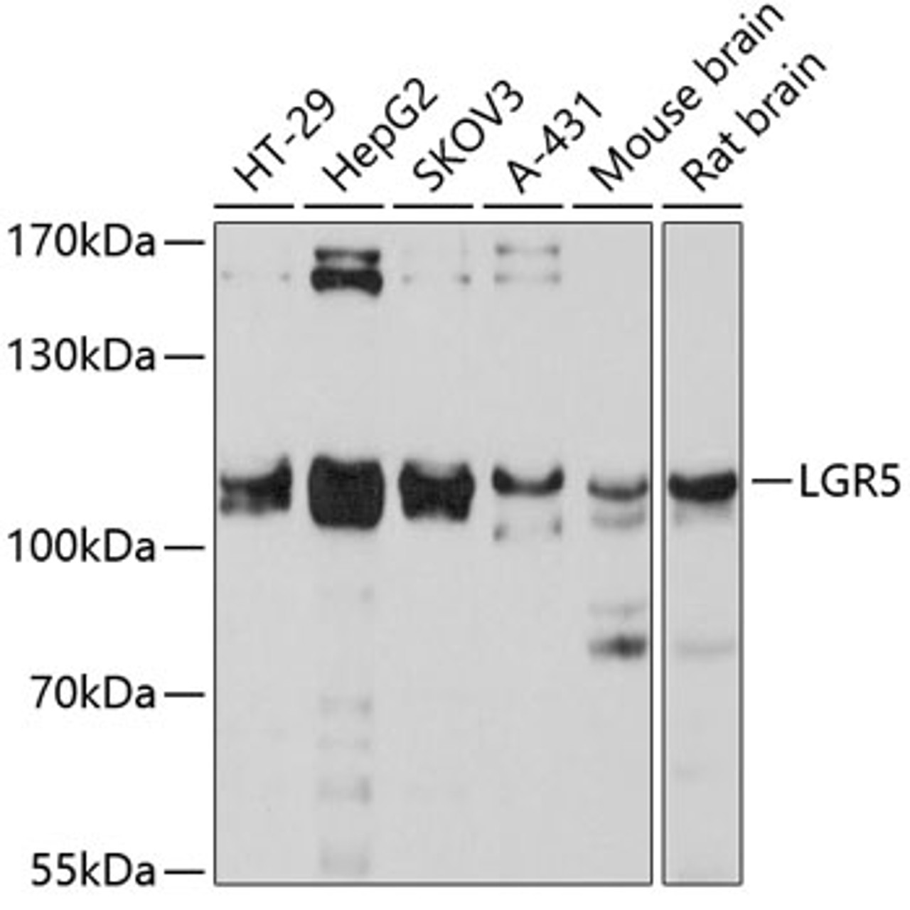 Western blot analysis of extracts of various cell lines, using LGR5 antibody (13-711) at 1:3000 dilution.<br/>Secondary antibody: HRP Goat Anti-Rabbit IgG (H+L) at 1:10000 dilution.<br/>Lysates/proteins: 25ug per lane.<br/>Blocking buffer: 3% nonfat dry milk in TBST.<br/>Detection: ECL Basic Kit.<br/>Exposure time: 10s.