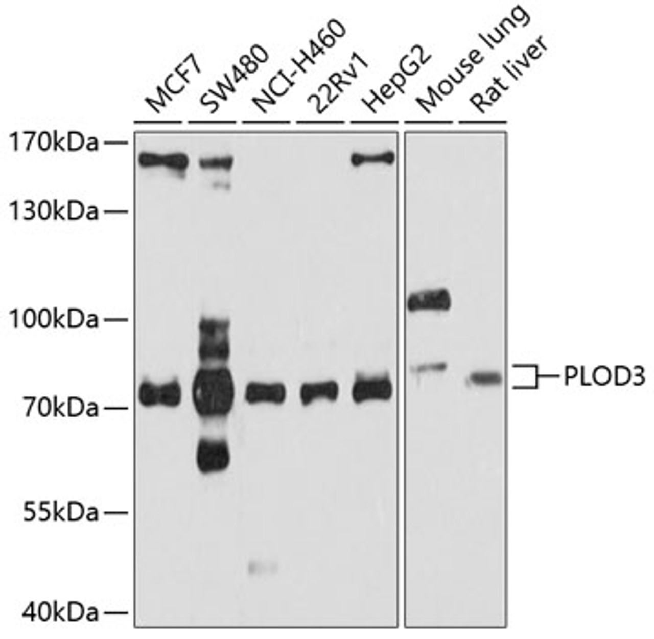 Western blot analysis of extracts of various cell lines, using PLOD3 antibody (13-712) at 1:1000 dilution.<br/>Secondary antibody: HRP Goat Anti-Rabbit IgG (H+L) at 1:10000 dilution.<br/>Lysates/proteins: 25ug per lane.<br/>Blocking buffer: 3% nonfat dry milk in TBST.<br/>Detection: ECL Basic Kit.<br/>Exposure time: 15s.