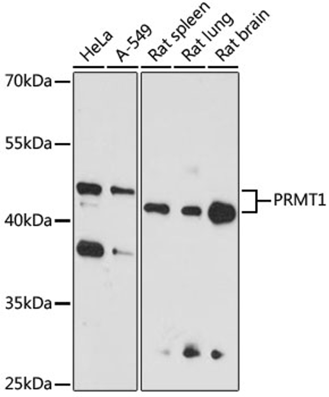 Western blot analysis of extracts of various cell lines, using PRMT1 antibody (13-714) at 1:1000 dilution.<br/>Secondary antibody: HRP Goat Anti-Rabbit IgG (H+L) at 1:10000 dilution.<br/>Lysates/proteins: 25ug per lane.<br/>Blocking buffer: 3% nonfat dry milk in TBST.<br/>Detection: ECL Basic Kit.<br/>Exposure time: 90s.