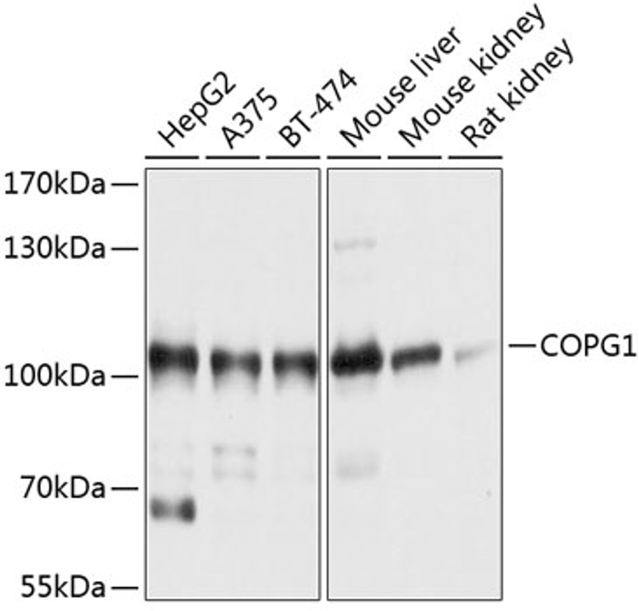 Western blot analysis of extracts of various cell lines, using COPG1 antibody (13-716) at 1:1000 dilution.<br/>Secondary antibody: HRP Goat Anti-Rabbit IgG (H+L) at 1:10000 dilution.<br/>Lysates/proteins: 25ug per lane.<br/>Blocking buffer: 3% nonfat dry milk in TBST.<br/>Detection: ECL Basic Kit.<br/>Exposure time: 1s.