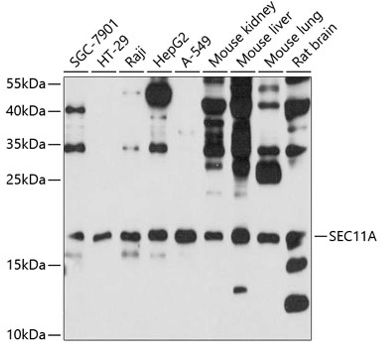 Western blot analysis of extracts of various cell lines, using SEC11A antibody (13-717) at 1:1000 dilution.<br/>Secondary antibody: HRP Goat Anti-Rabbit IgG (H+L) at 1:10000 dilution.<br/>Lysates/proteins: 25ug per lane.<br/>Blocking buffer: 3% nonfat dry milk in TBST.<br/>Detection: ECL Basic Kit.<br/>Exposure time: 90s.