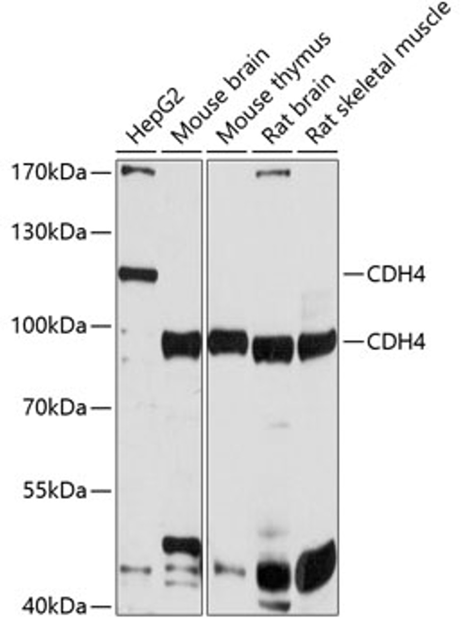 Western blot analysis of extracts of various cell lines, using CDH4 antibody (13-721) at 1:1000 dilution.<br/>Secondary antibody: HRP Goat Anti-Rabbit IgG (H+L) at 1:10000 dilution.<br/>Lysates/proteins: 25ug per lane.<br/>Blocking buffer: 3% nonfat dry milk in TBST.<br/>Detection: ECL Basic Kit.<br/>Exposure time: 10s.