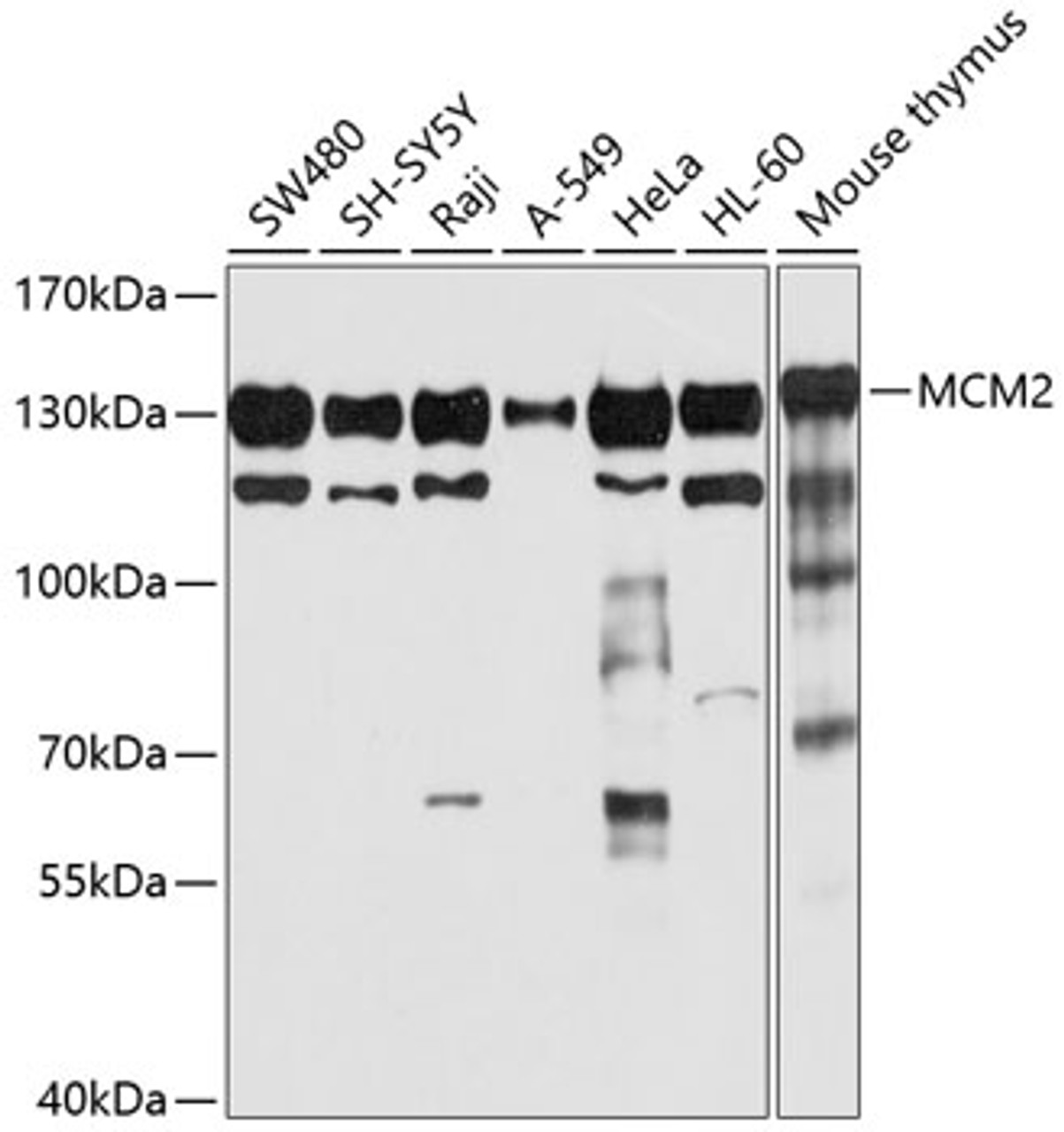 Western blot analysis of extracts of various cell lines, using MCM2 antibody (13-723) at 1:1000 dilution.<br/>Secondary antibody: HRP Goat Anti-Rabbit IgG (H+L) at 1:10000 dilution.<br/>Lysates/proteins: 25ug per lane.<br/>Blocking buffer: 3% nonfat dry milk in TBST.<br/>Detection: ECL Basic Kit.<br/>Exposure time: 10s.