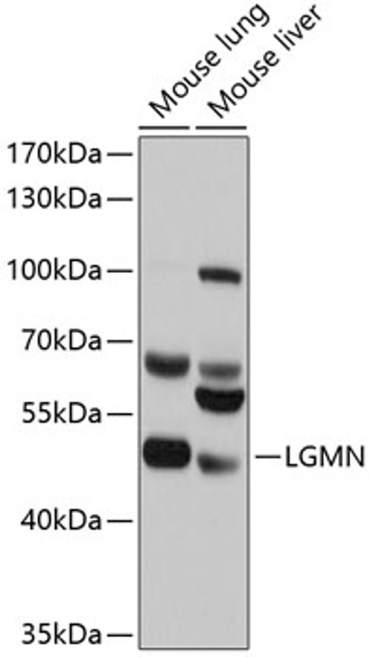 Western blot analysis of extracts of various cell lines, using LGMN antibody (13-728) at 1:1000 dilution.<br/>Secondary antibody: HRP Goat Anti-Rabbit IgG (H+L) at 1:10000 dilution.<br/>Lysates/proteins: 25ug per lane.<br/>Blocking buffer: 3% nonfat dry milk in TBST.<br/>Detection: ECL Basic Kit.<br/>Exposure time: 1s.