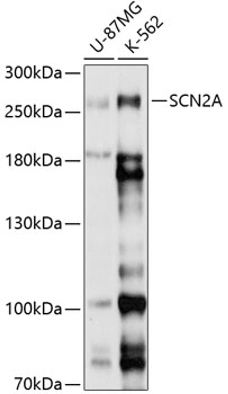 Western blot analysis of extracts of various cell lines, using SCN2A antibody (13-732) at 1:1000 dilution.<br/>Secondary antibody: HRP Goat Anti-Rabbit IgG (H+L) at 1:10000 dilution.<br/>Lysates/proteins: 25ug per lane.<br/>Blocking buffer: 3% nonfat dry milk in TBST.<br/>Detection: ECL Basic Kit.<br/>Exposure time: 5s.