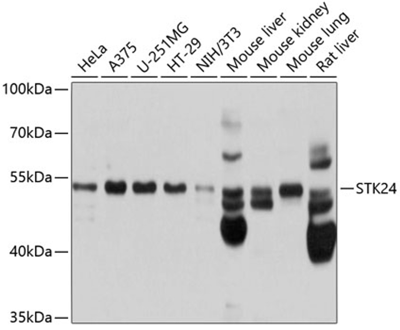 Western blot analysis of extracts of various cell lines, using STK24 antibody (13-733) at 1:1000 dilution.<br/>Secondary antibody: HRP Goat Anti-Rabbit IgG (H+L) at 1:10000 dilution.<br/>Lysates/proteins: 25ug per lane.<br/>Blocking buffer: 3% nonfat dry milk in TBST.<br/>Detection: ECL Basic Kit.<br/>Exposure time: 1s.