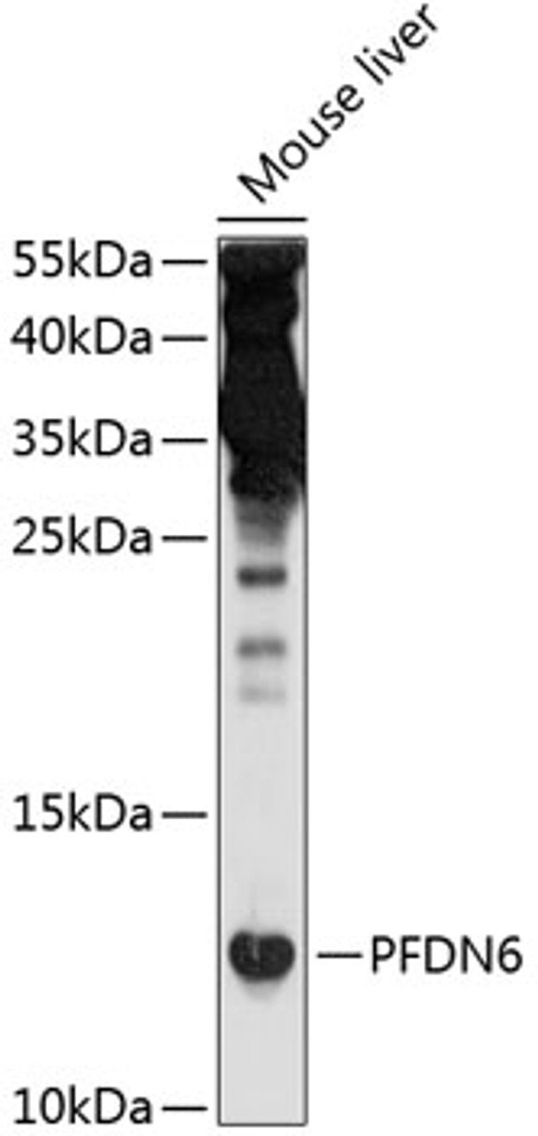 Western blot analysis of extracts of mouse liver, using PFDN6 antibody (13-735) at 1:1000 dilution.<br/>Secondary antibody: HRP Goat Anti-Rabbit IgG (H+L) at 1:10000 dilution.<br/>Lysates/proteins: 25ug per lane.<br/>Blocking buffer: 3% nonfat dry milk in TBST.<br/>Detection: ECL Enhanced Kit.<br/>Exposure time: 30s.