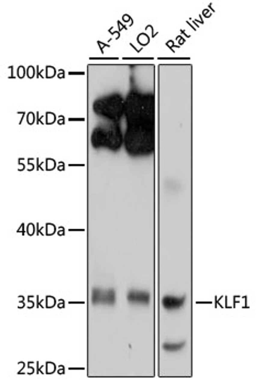 Western blot analysis of extracts of various cell lines, using KLF1 antibody (13-736) at 1:1000 dilution.<br/>Secondary antibody: HRP Goat Anti-Rabbit IgG (H+L) at 1:10000 dilution.<br/>Lysates/proteins: 25ug per lane.<br/>Blocking buffer: 3% nonfat dry milk in TBST.<br/>Detection: ECL Enhanced Kit.<br/>Exposure time: 30s.