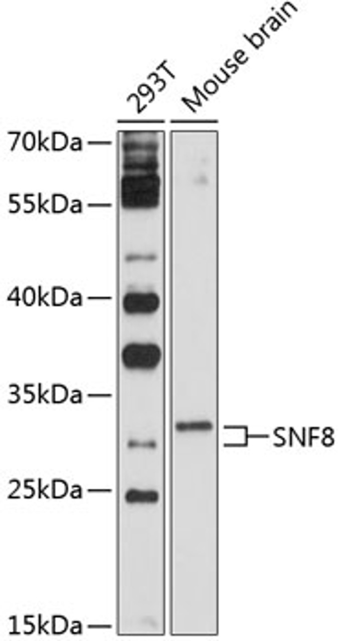 Western blot analysis of extracts of various cell lines, using SNF8 antibody (13-737) at 1:1000 dilution.<br/>Secondary antibody: HRP Goat Anti-Rabbit IgG (H+L) at 1:10000 dilution.<br/>Lysates/proteins: 25ug per lane.<br/>Blocking buffer: 3% nonfat dry milk in TBST.<br/>Detection: ECL Basic Kit.<br/>Exposure time: 30s.