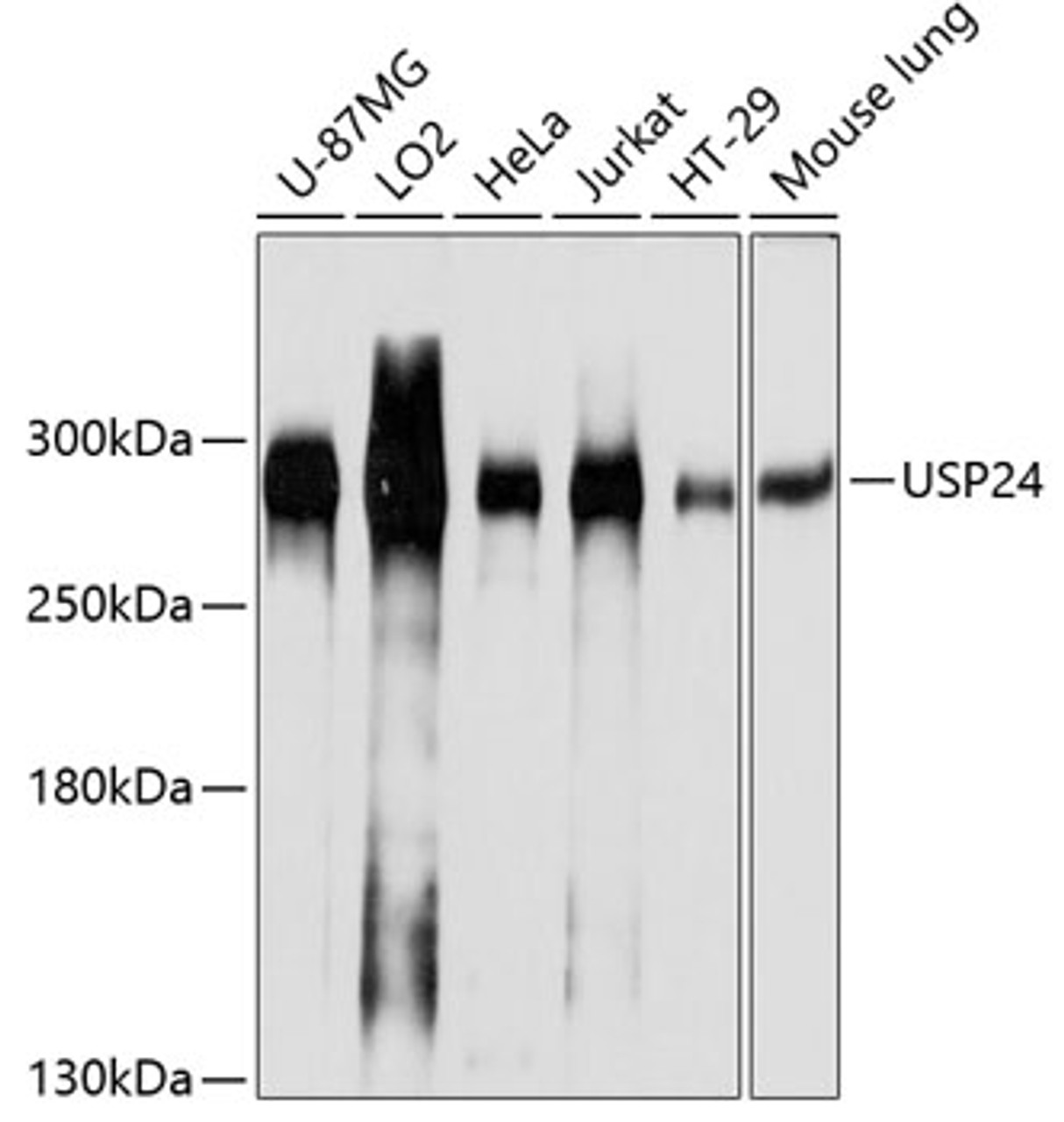 Western blot analysis of extracts of various cell lines, using USP24 antibody (13-739) at 1:1000 dilution.<br/>Secondary antibody: HRP Goat Anti-Rabbit IgG (H+L) at 1:10000 dilution.<br/>Lysates/proteins: 25ug per lane.<br/>Blocking buffer: 3% nonfat dry milk in TBST.<br/>Detection: ECL Basic Kit.<br/>Exposure time: 1s.