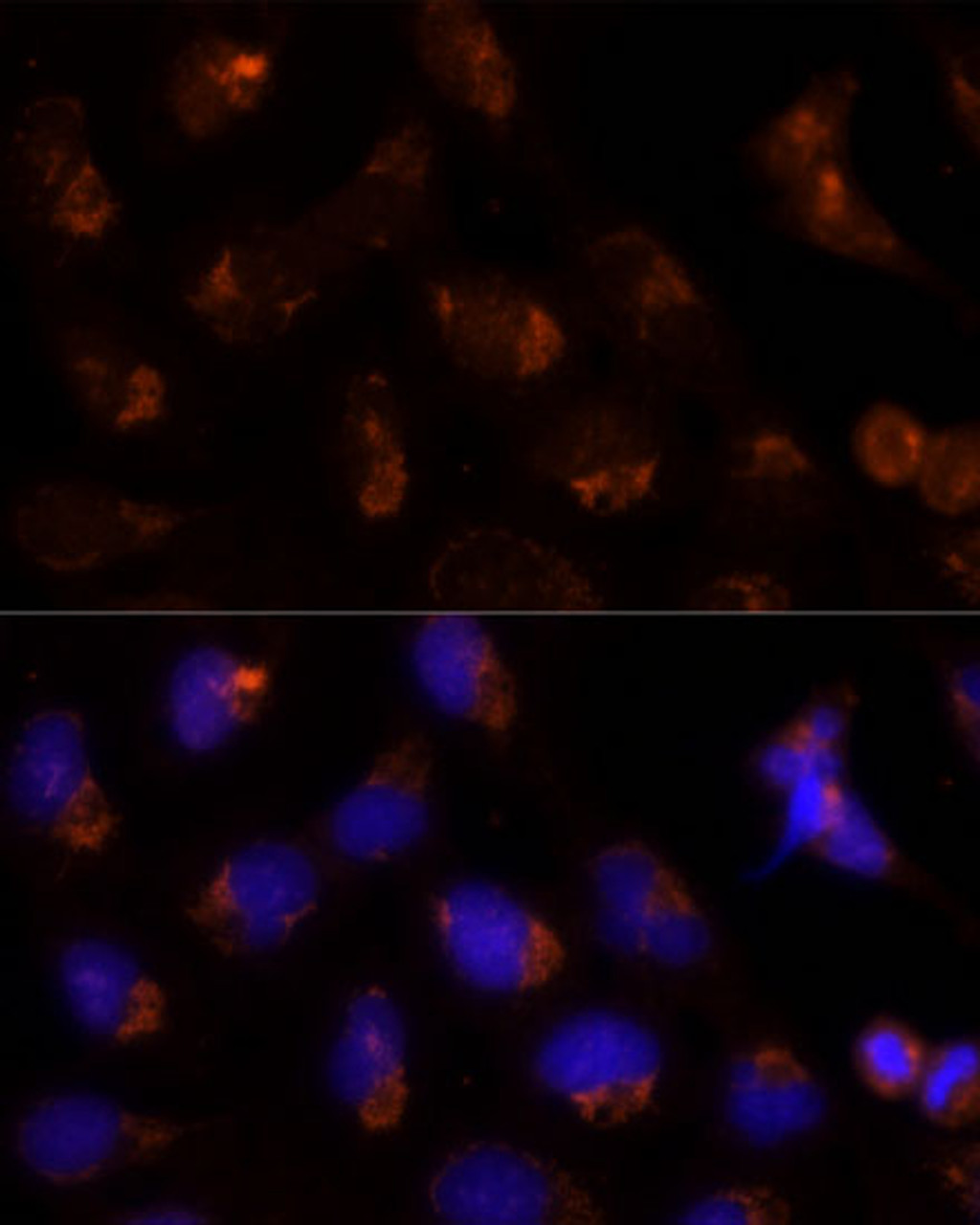 Immunofluorescence analysis of U-2 OS cells using SEC14L2 Polyclonal Antibody (13-740) at dilution of 1:100 (40x lens) . Blue: DAPI for nuclear staining.