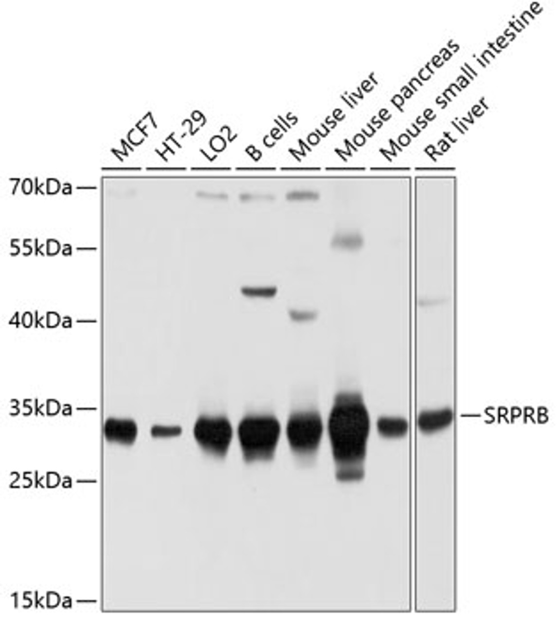 Western blot analysis of extracts of various cell lines, using SRPRB antibody (13-746) at 1:1000 dilution.<br/>Secondary antibody: HRP Goat Anti-Rabbit IgG (H+L) at 1:10000 dilution.<br/>Lysates/proteins: 25ug per lane.<br/>Blocking buffer: 3% nonfat dry milk in TBST.<br/>Detection: ECL Basic Kit.<br/>Exposure time: 5s.