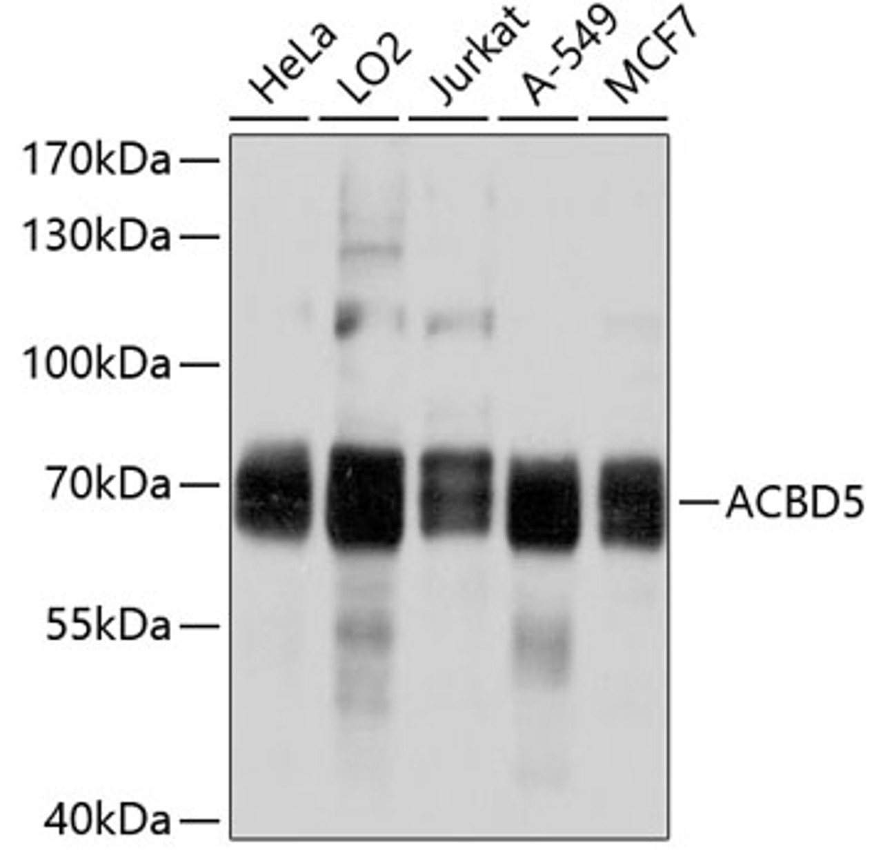 Western blot analysis of extracts of various cell lines, using ACBD5 antibody (13-749) at 1:1000 dilution.<br/>Secondary antibody: HRP Goat Anti-Rabbit IgG (H+L) at 1:10000 dilution.<br/>Lysates/proteins: 25ug per lane.<br/>Blocking buffer: 3% nonfat dry milk in TBST.<br/>Detection: ECL Basic Kit.<br/>Exposure time: 1s.