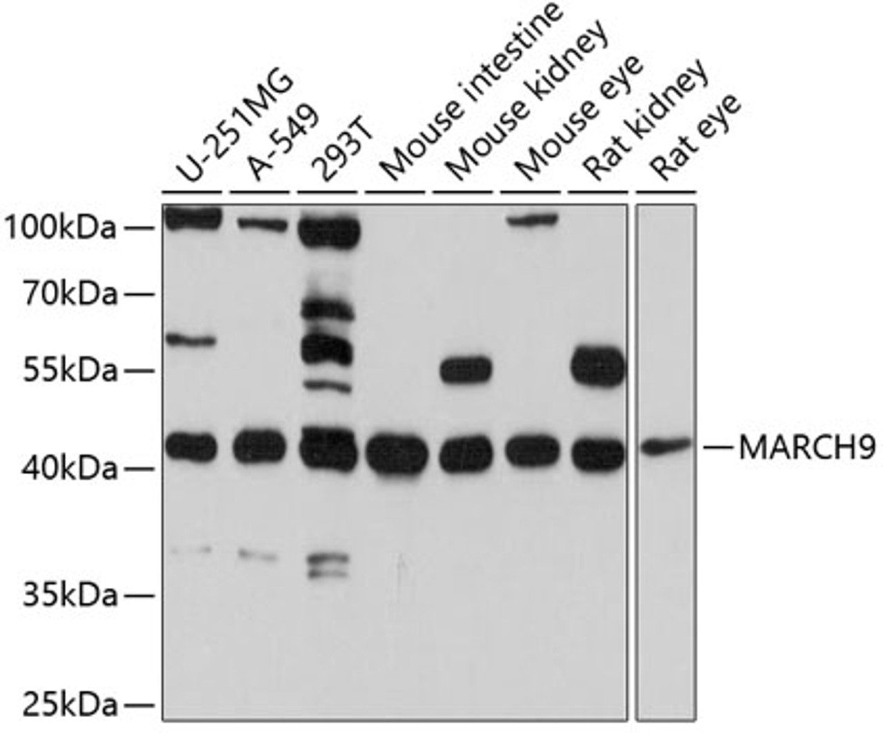 Western blot analysis of extracts of various cell lines, using MARCH9 antibody (13-750) at 1:1000 dilution.<br/>Secondary antibody: HRP Goat Anti-Rabbit IgG (H+L) at 1:10000 dilution.<br/>Lysates/proteins: 25ug per lane.<br/>Blocking buffer: 3% nonfat dry milk in TBST.<br/>Detection: ECL Basic Kit.<br/>Exposure time: 5s.