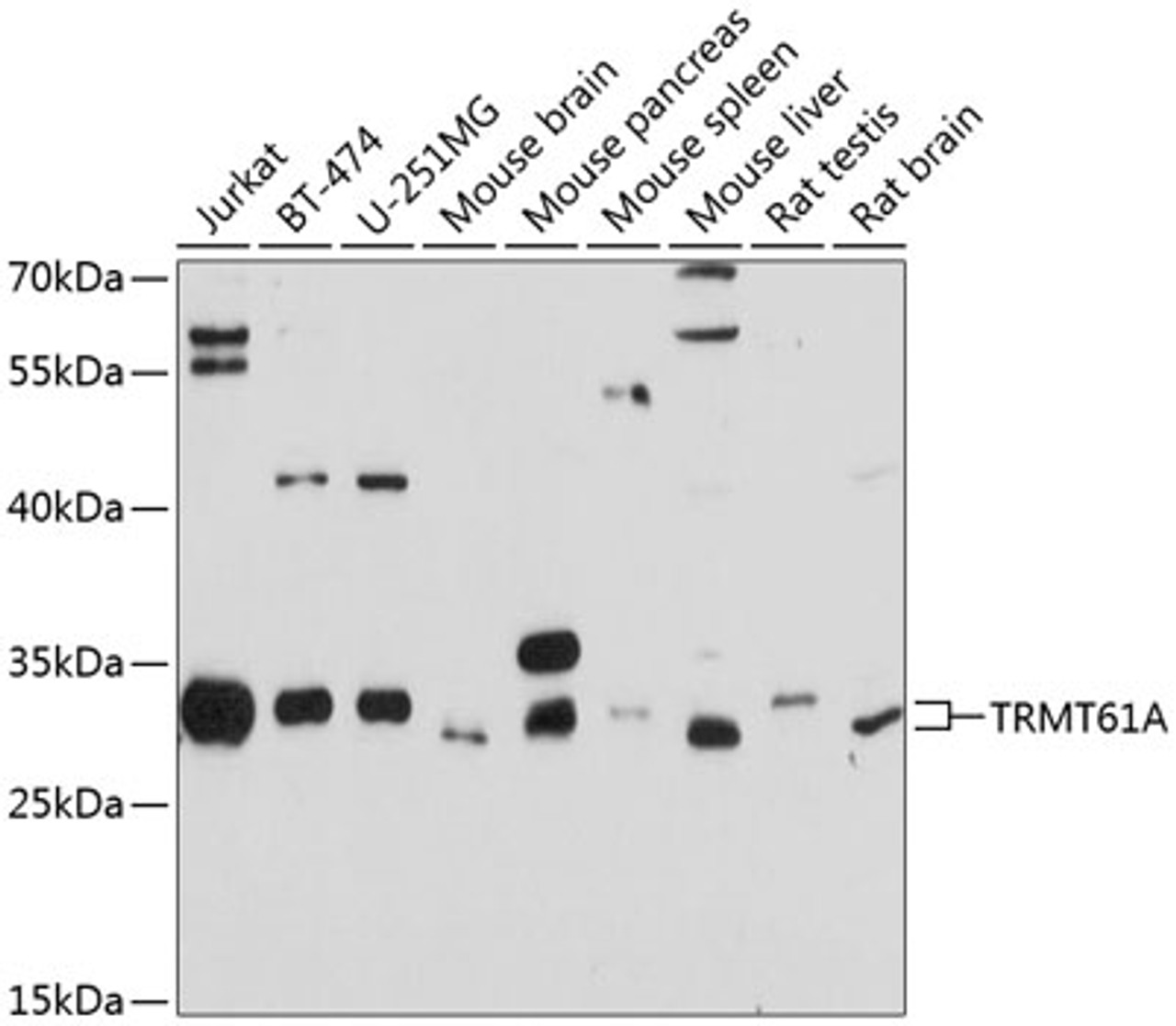 Western blot analysis of extracts of various cell lines, using TRMT61A antibody (13-751) at 1:1000 dilution.<br/>Secondary antibody: HRP Goat Anti-Rabbit IgG (H+L) at 1:10000 dilution.<br/>Lysates/proteins: 25ug per lane.<br/>Blocking buffer: 3% nonfat dry milk in TBST.<br/>Detection: ECL Basic Kit.<br/>Exposure time: 10s.