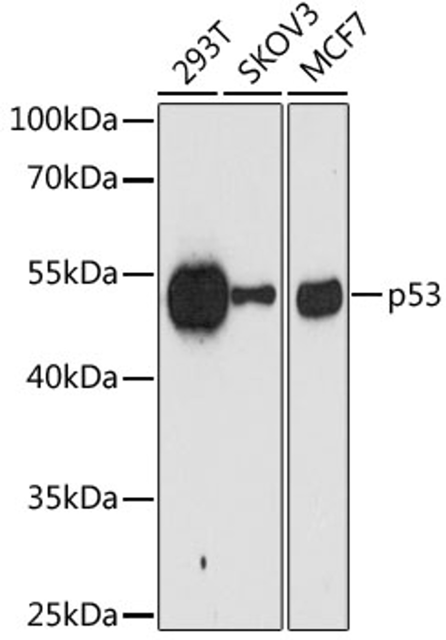 Western blot analysis of extracts of various cell lines, using p53 antibody (13-759) at 1:1000 dilution.<br/>Secondary antibody: HRP Goat Anti-Mouse IgG (H+L) (AS003) at 1:10000 dilution.<br/>Lysates/proteins: 25ug per lane.<br/>Blocking buffer: 3% nonfat dry milk in TBST.<br/>Detection: ECL Basic Kit.<br/>Exposure time: 90s.