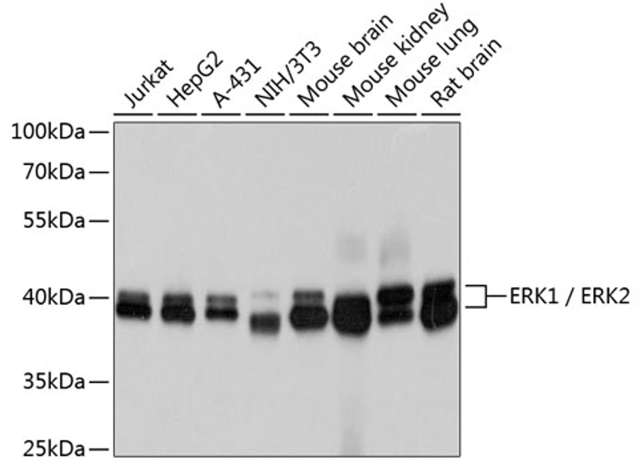 Western blot analysis of extracts of various cell lines, using ERK1 / ERK2 antibody (13-762) at 1:1000 dilution.<br/>Secondary antibody: HRP Goat Anti-Mouse IgG (H+L) (AS003) at 1:10000 dilution.<br/>Lysates/proteins: 25ug per lane.<br/>Blocking buffer: 3% nonfat dry milk in TBST.<br/>Detection: ECL Basic Kit.<br/>Exposure time: 5s.