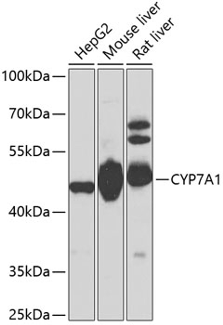 Western blot analysis of extracts of various cell lines, using CYP7A1 antibody (13-763) at 1:1000 dilution.<br/>Secondary antibody: HRP Goat Anti-Rabbit IgG (H+L) at 1:10000 dilution.<br/>Lysates/proteins: 25ug per lane.<br/>Blocking buffer: 3% nonfat dry milk in TBST.<br/>Detection: ECL Basic Kit.<br/>Exposure time: 40s.