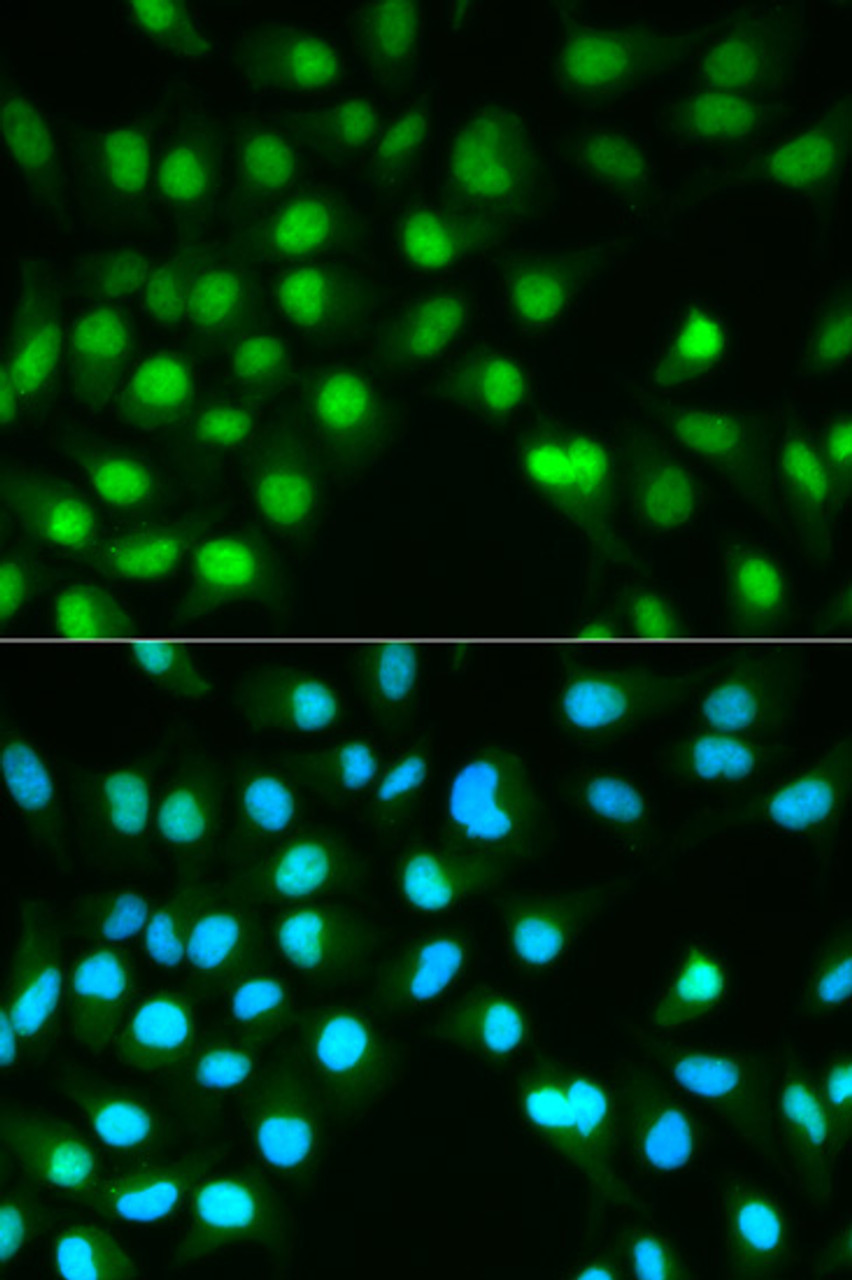 Immunofluorescence analysis of HeLa cells using PPP3CA antibody (13-765) . Blue: DAPI for nuclear staining.