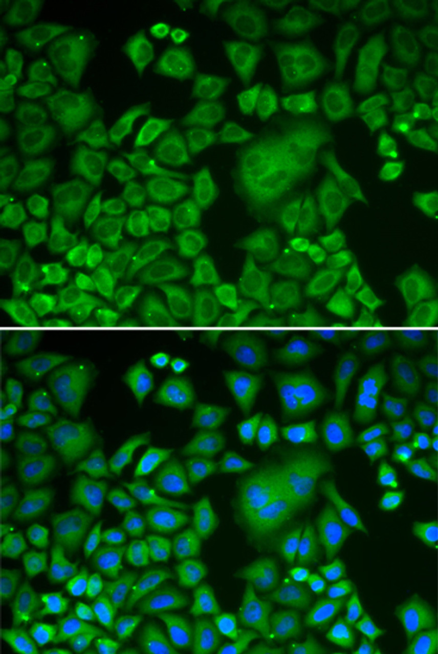 Immunofluorescence analysis of HeLa cells using ACTR3 antibody (13-766) . Blue: DAPI for nuclear staining.