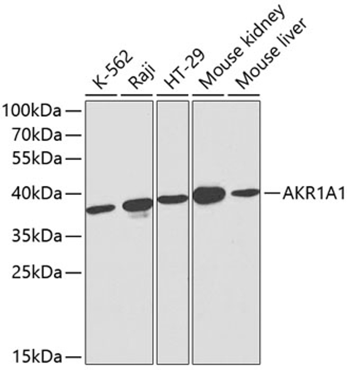 Western blot analysis of extracts of various cell lines, using AKR1A1 antibody (13-770) at 1:1000 dilution.<br/>Secondary antibody: HRP Goat Anti-Rabbit IgG (H+L) at 1:10000 dilution.<br/>Lysates/proteins: 25ug per lane.<br/>Blocking buffer: 3% nonfat dry milk in TBST.