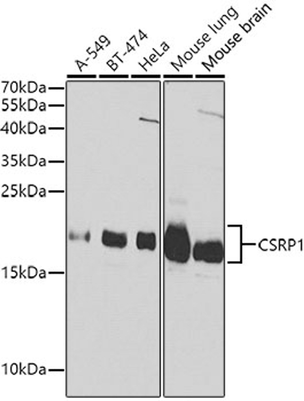 Western blot analysis of extracts of various cell lines, using CSRP1 Antibody (13-771) at 1:1000 dilution.<br/>Secondary antibody: HRP Goat Anti-Rabbit IgG (H+L) at 1:10000 dilution.<br/>Lysates/proteins: 25ug per lane.<br/>Blocking buffer: 3% nonfat dry milk in TBST.<br/>Detection: ECL Basic Kit.
