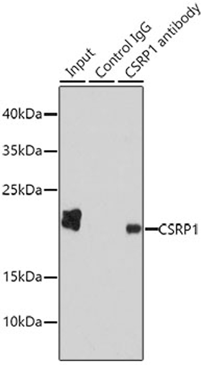 Immunoprecipitation analysis of 200ug extracts of HepG2 cells using 1ug CSRP1 antibody (13-771) . Western blot was performed from the immunoprecipitate using CSRP1 antibody (13-771) at a dilition of 1:1000.