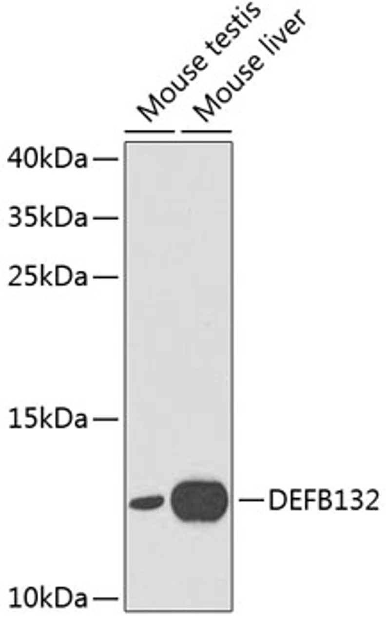 Western blot analysis of extracts of various cell lines, using DEFB132 antibody (13-778) at 1:1000 dilution.<br/>Secondary antibody: HRP Goat Anti-Rabbit IgG (H+L) at 1:10000 dilution.<br/>Lysates/proteins: 25ug per lane.<br/>Blocking buffer: 3% nonfat dry milk in TBST.