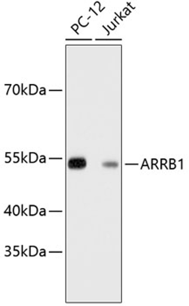 Western blot analysis of extracts of various cell lines, using ARRB1 antibody (13-780) .<br/>Secondary antibody: HRP Goat Anti-Rabbit IgG (H+L) at 1:10000 dilution.<br/>Lysates/proteins: 25ug per lane.<br/>Blocking buffer: 3% nonfat dry milk in TBST.