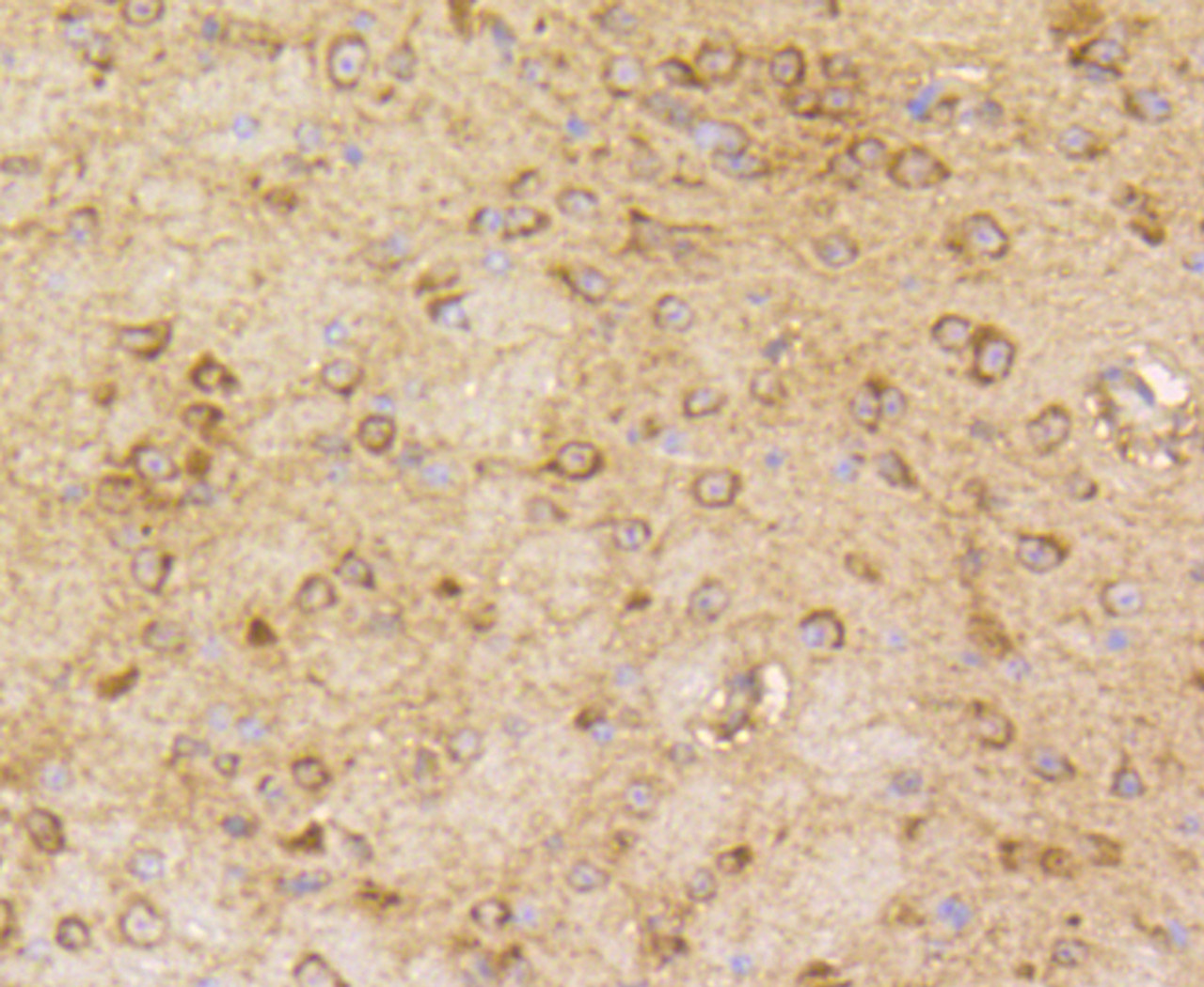 Immunohistochemistry of paraffin-embedded mouse brain using ARRB1 antibody (13-780) at dilution of 1:100 (40x lens) .