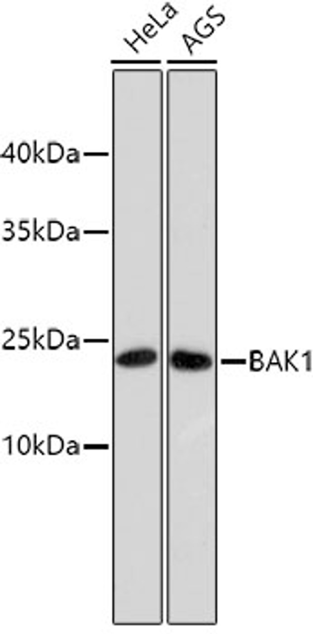 Western blot analysis of extracts of various cell lines, using BAK1 antibody (13-783) .<br/>Secondary antibody: HRP Goat Anti-Rabbit IgG (H+L) at 1:10000 dilution.<br/>Lysates/proteins: 25ug per lane.<br/>Blocking buffer: 3% nonfat dry milk in TBST.